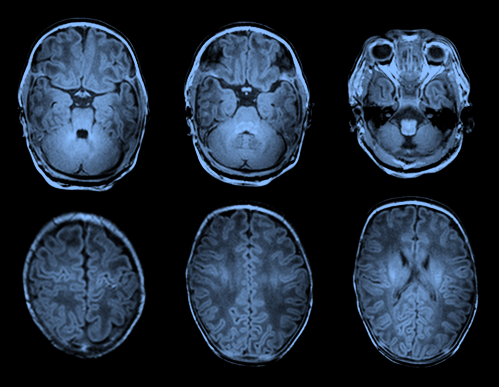 Automatic analysis of the developing neonatal brain – qurAI